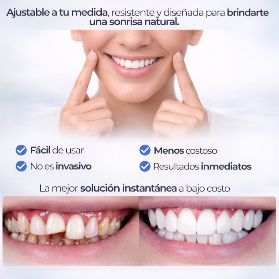 Snap Smile — Carillas Dentales Removibles 2x1 · Sonrisa Perfecta al Instante 😁